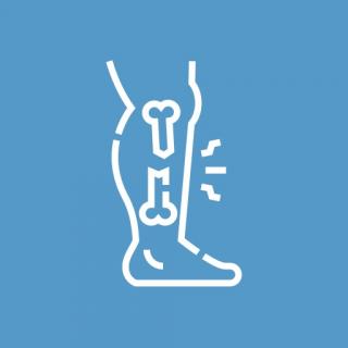 Перелом костей ноги