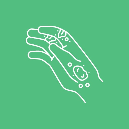 Боль на коже рук