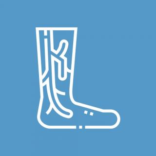 Тромбоз глубоких вен нижних конечностей